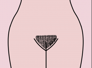 Bikini Trim Pubic hair trimmed along the bikini line